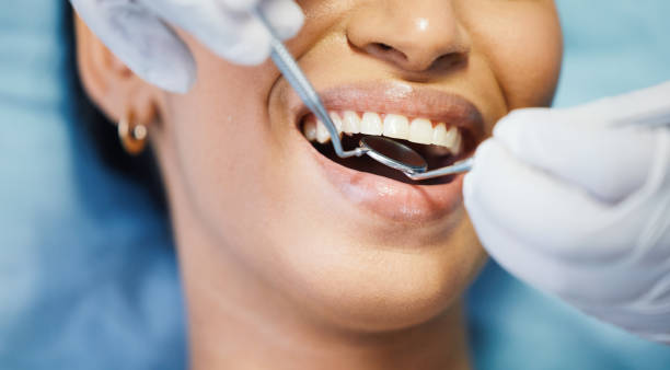 Best Emergency TMJ Treatment in Clifton, TN
