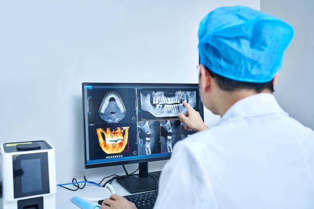 Best Emergency Tooth Extraction in Clifton, TN